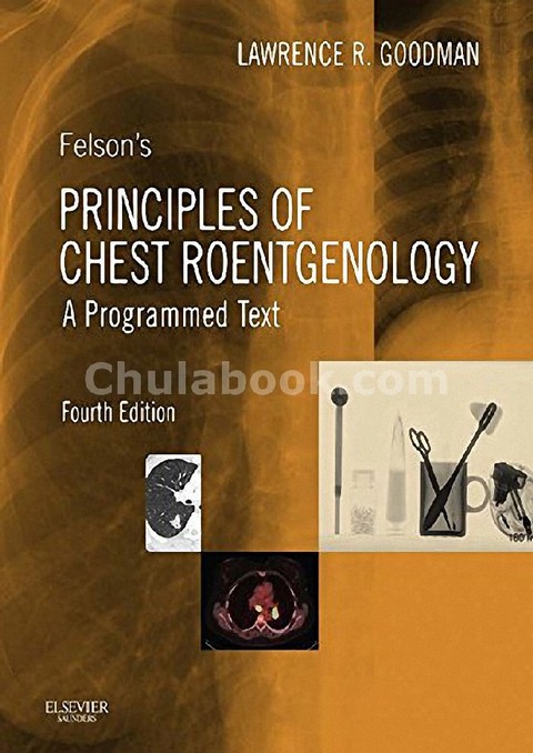 FELSON'S PRINCIPLES OF CHEST ROENTGENOLOGY: A PROGRAMMED TEXT