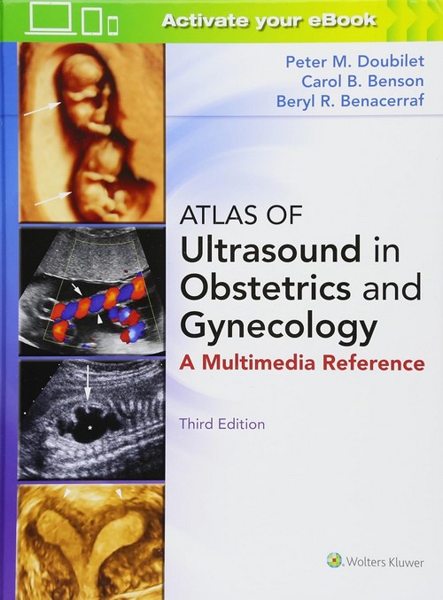 ATLAS OF ULTRASOUND IN OBSTETRICS AND GYNECOLOGY (HC)