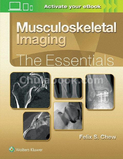 MUSCULOSKELETAL IMAGING: THE ESSENTIALS