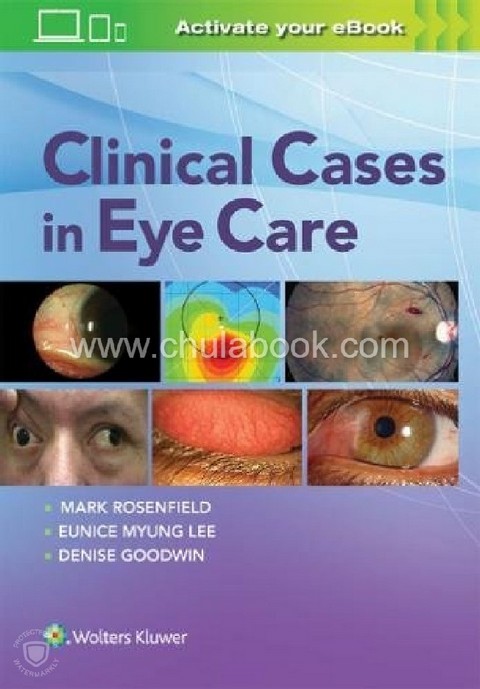 CLINICAL CASES IN EYE CARE