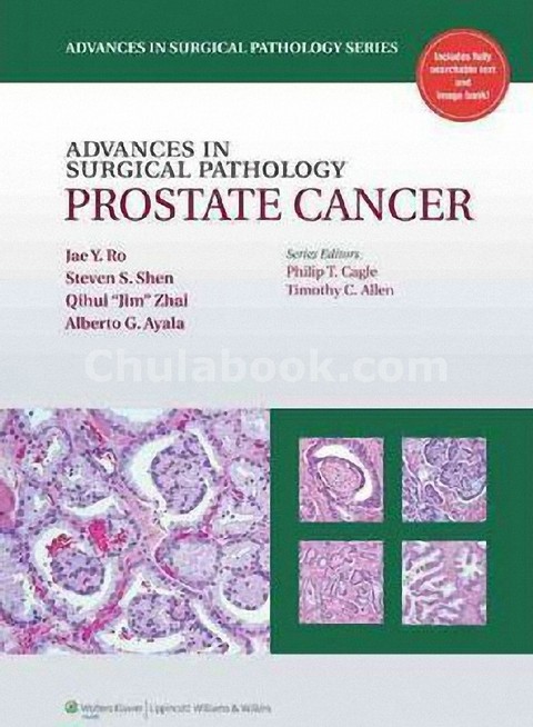 ADVANCES IN SURGICAL PATHOLOGY: PROSTATE CANCER (ADVANCES IN SURGICAL PATHOLOGY)