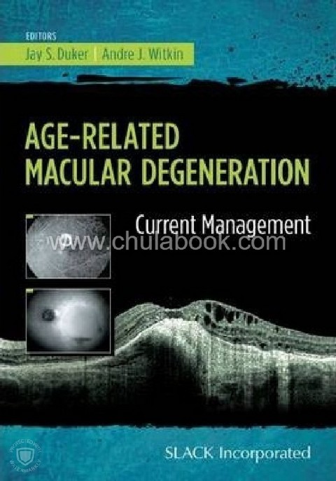 AGE-RELATED MACULAR DEGENERATION: CURRENT MANAGEMENT
