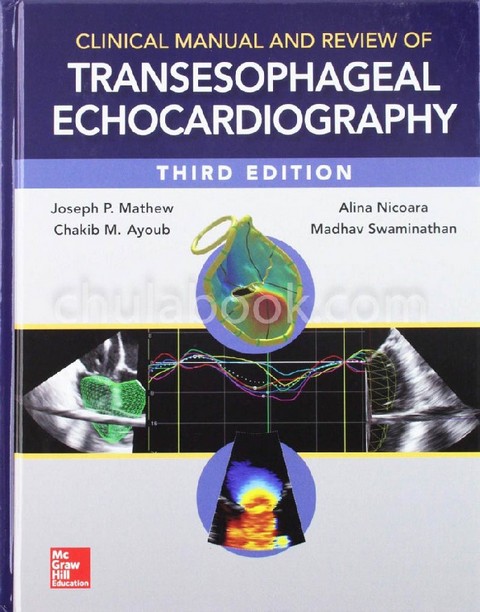 CLINICAL MANUAL AND REVIEW OF TRANSESOPHAGEAL ECHOCARDIOGRAPHY (HC)