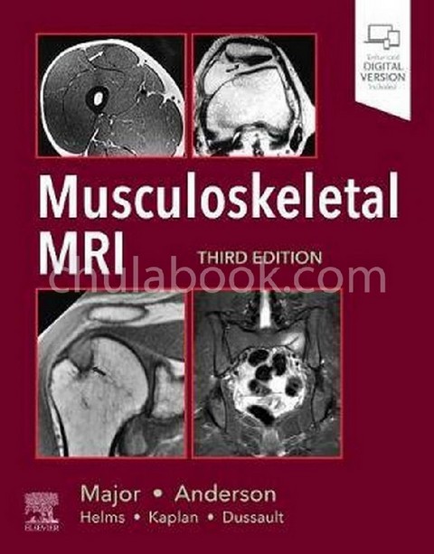 MUSCULOSKELETAL MRI (HC)