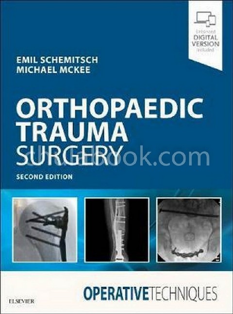 OPERATIVE TECHNIQUES: ORTHOPAEDIC TRAUMA SURGERY (HC)