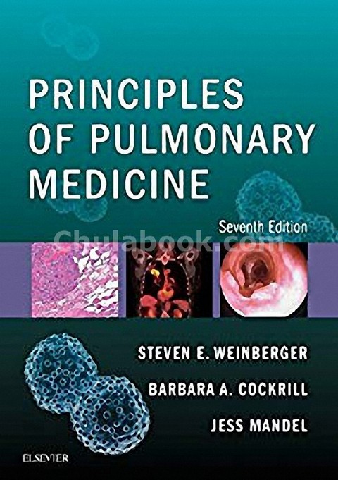 PRINCIPLES OF PULMONARY MEDICINE