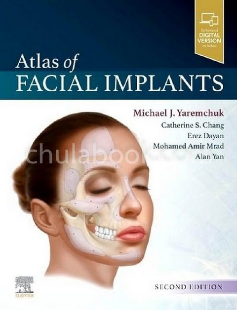 ATLAS OF FACIAL IMPLANTS (HC)