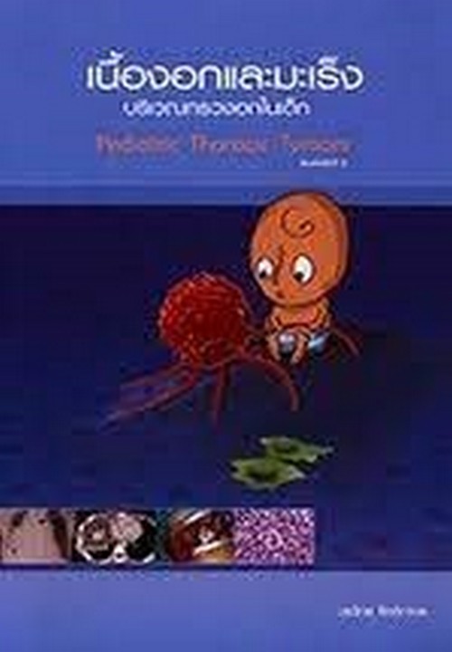 เนื้องอกและมะเร็งบริเวณทรวงอกในเด็ก (PEDIATRIC THORACIC TUMORS)