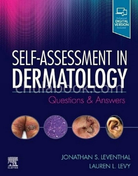SELF-ASSESSMENT IN DERMATOLOGY: QUESTIONS AND ANSWERS