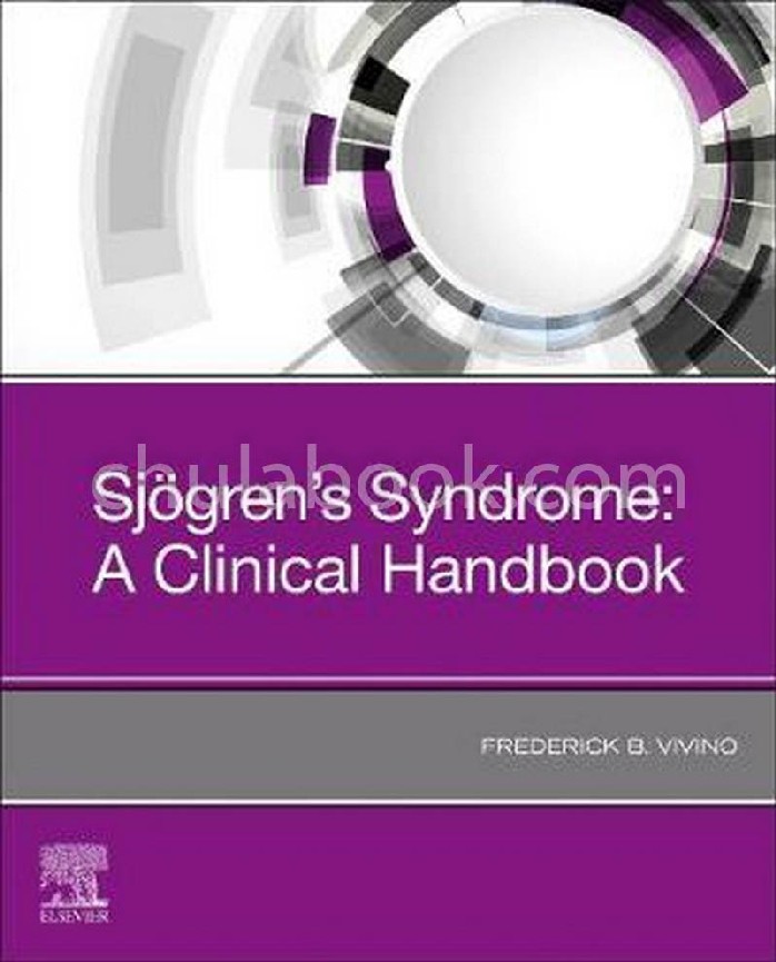 SJOGRENS SYNDROME: A CLINICAL HANDBOOK