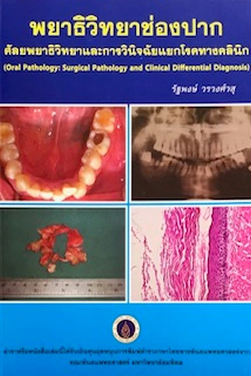 พยาธิวิทยาช่องปาก :ศัลยพยาธิวิทยาและการวินิจฉัยแยกโรคทางคลินิก (ราคาปก 1,200.-)