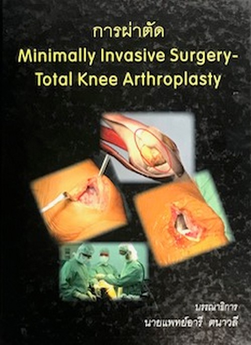 การผ่าตัด (MINIMALLY INVASIVE SUREGRY-TOTAL KNEE ARTHROPLASTY)