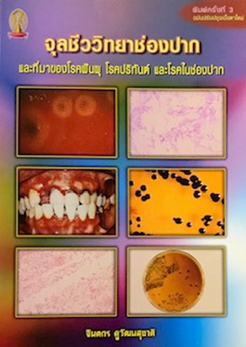 จุลชีววิทยาช่องปาก และที่มาของโรคฟันผุ โรคปริทันต์ และโรคในช่องปาก (ฉบับปรับปรุงเนื้อหา)