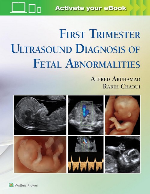 FIRST TRIMESTER ULTRASOUND DIAGNOSIS OF FETAL ABNORMALITIES