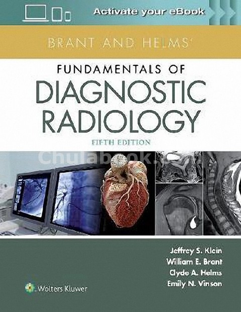 BRANT AND HELMS' FUNDAMENTALS OF DIAGNOSTIC RADIOLOGY