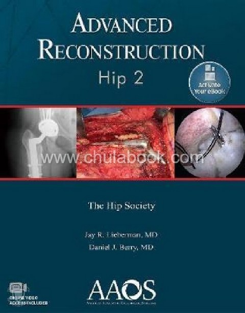 ADVANCED RECONSTRUCTION HIP 2: THE HIP SOCIETY (ONLINE VIDEO ACCESS INCLUDED)